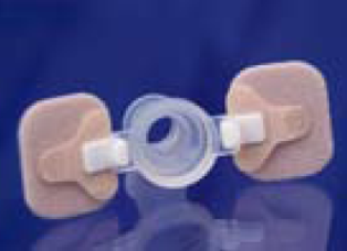 v01stgzokuldysctskev